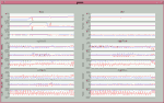 Joint Graphs